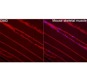 Immunofluorescence - Anti-Dystrophin Antibody (A329330) - Antibodies.com