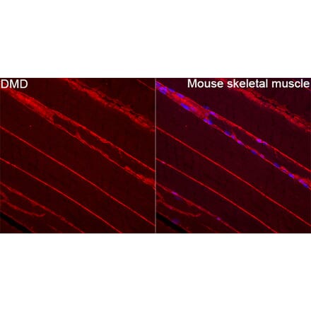 Immunofluorescence - Anti-Dystrophin Antibody (A329330) - Antibodies.com