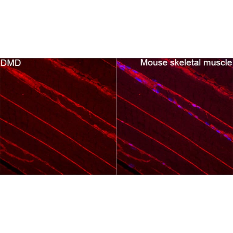 Immunofluorescence - Anti-Dystrophin Antibody (A329330) - Antibodies.com