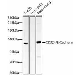 Western Blot - Anti-E Cadherin Antibody (A329331) - Antibodies.com