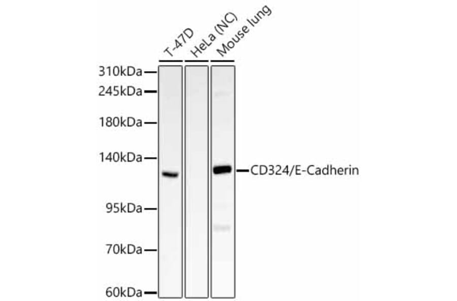 Western Blot - Anti-E Cadherin Antibody (A329331) - Antibodies.com