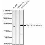 Western Blot - Anti-E Cadherin Antibody (A329331) - Antibodies.com