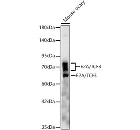 Western Blot - Anti-E2A Antibody [ARC61947] (A329332) - Antibodies.com