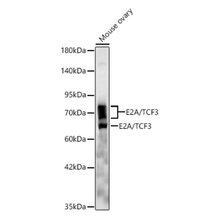 Western Blot - Anti-E2A Antibody [ARC61947] (A329332) - Antibodies.com