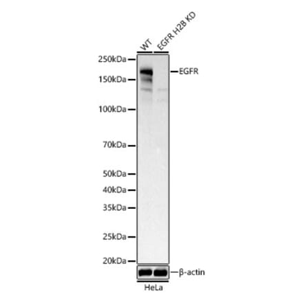 Western Blot - Anti-EGFR Antibody (A329338) - Antibodies.com
