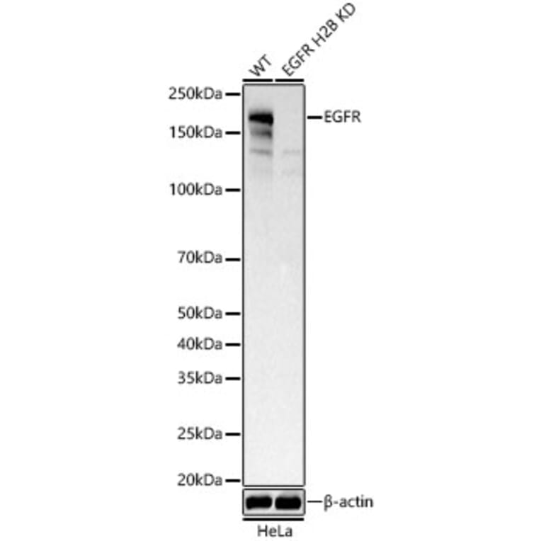 Western Blot - Anti-EGFR Antibody (A329338) - Antibodies.com