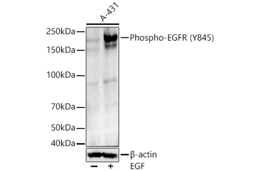 Western Blot - Anti-EGFR (Phospho Y845) Antibody (A329339) - Antibodies.com