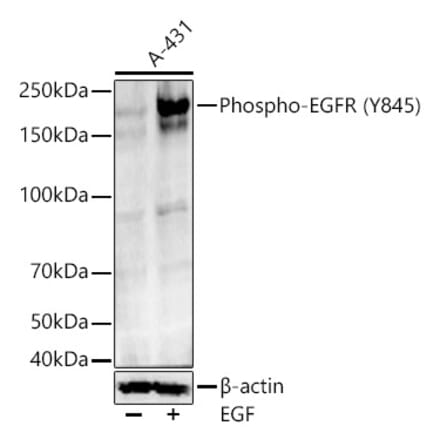 Western Blot - Anti-EGFR (Phospho Y845) Antibody (A329339) - Antibodies.com