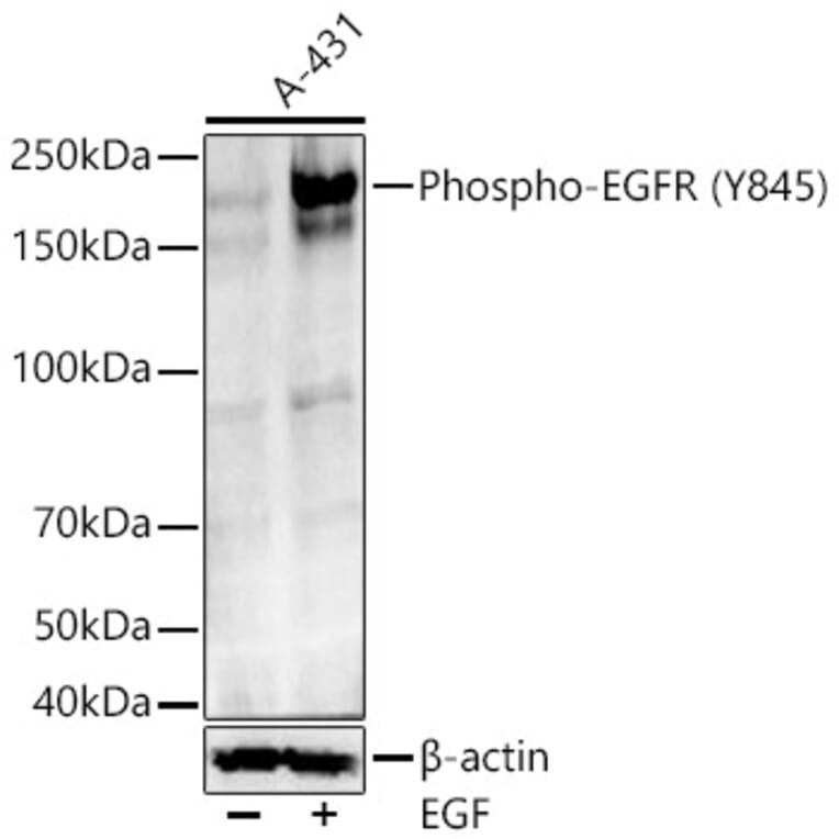 Western Blot - Anti-EGFR (Phospho Y845) Antibody (A329339) - Antibodies.com
