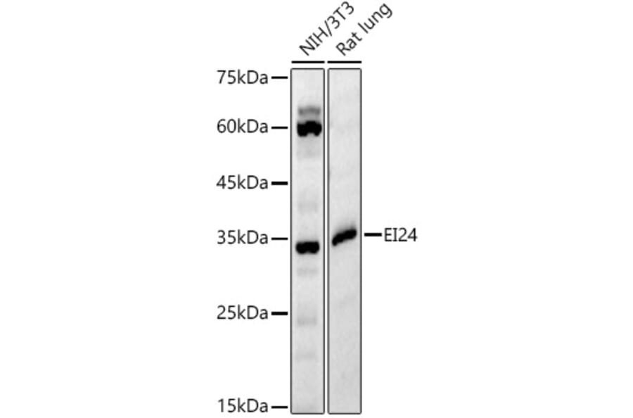 Western Blot - Anti-EI24 Antibody (A329340) - Antibodies.com