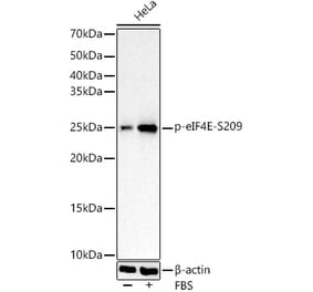 Western Blot - Anti-EIF4E (Phospho S209) Antibody [ARC1569] (A329341) - Antibodies.com