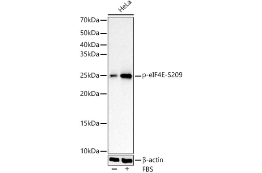 Western Blot - Anti-EIF4E (Phospho S209) Antibody [ARC1569] (A329341) - Antibodies.com