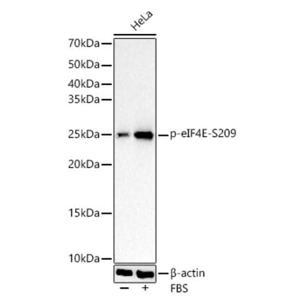 Western Blot - Anti-EIF4E (Phospho S209) Antibody [ARC1569] (A329341) - Antibodies.com