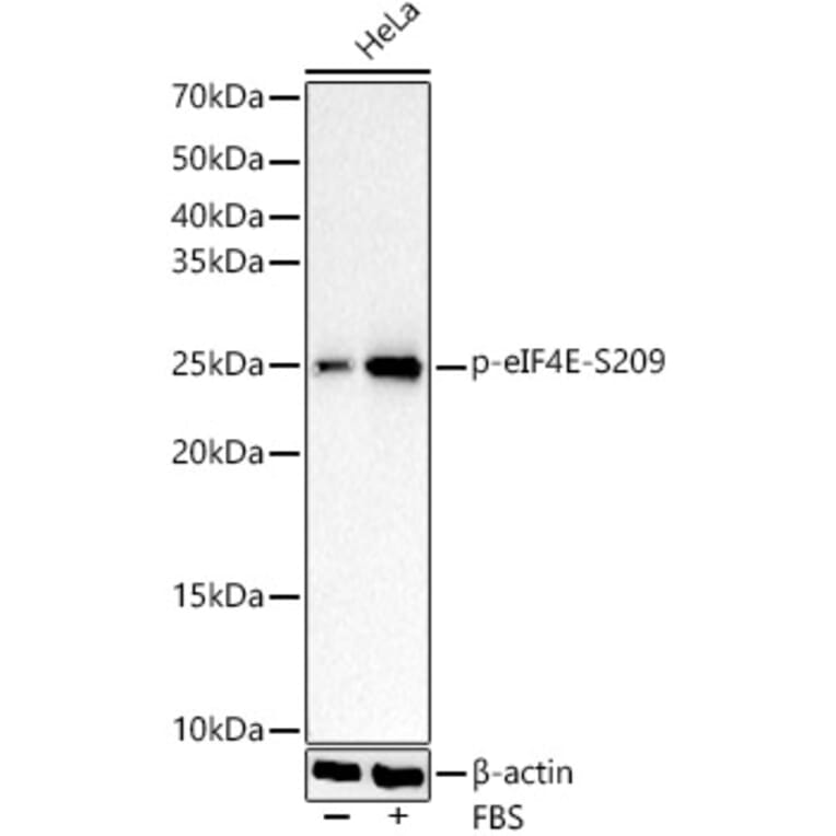 Western Blot - Anti-EIF4E (Phospho S209) Antibody [ARC1569] (A329341) - Antibodies.com