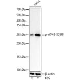 Western Blot - Anti-EIF4E (Phospho S209) Antibody [ARC1569] (A329341) - Antibodies.com
