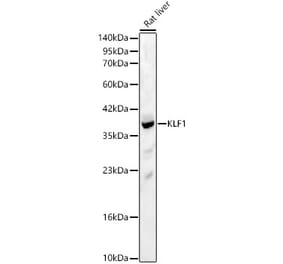 Western Blot - Anti-KLF1 Antibody (A329342) - Antibodies.com