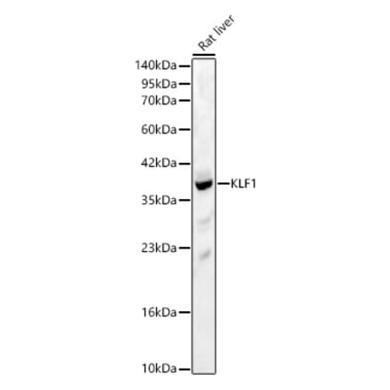 Western Blot - Anti-KLF1 Antibody (A329342) - Antibodies.com