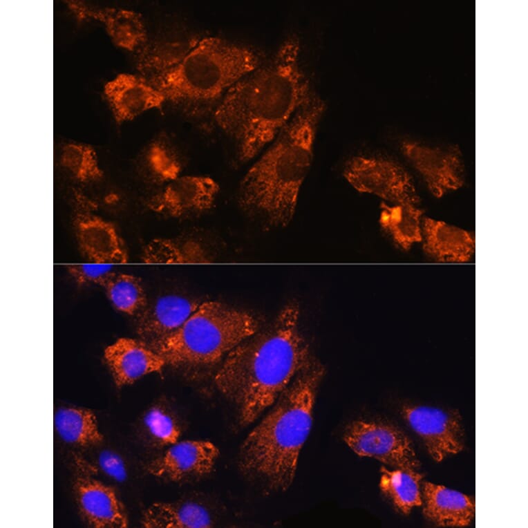 Immunofluorescence - Anti-ENPP1 Antibody (A329343) - Antibodies.com