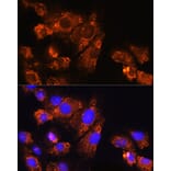 Immunofluorescence - Anti-ENPP1 Antibody (A329343) - Antibodies.com