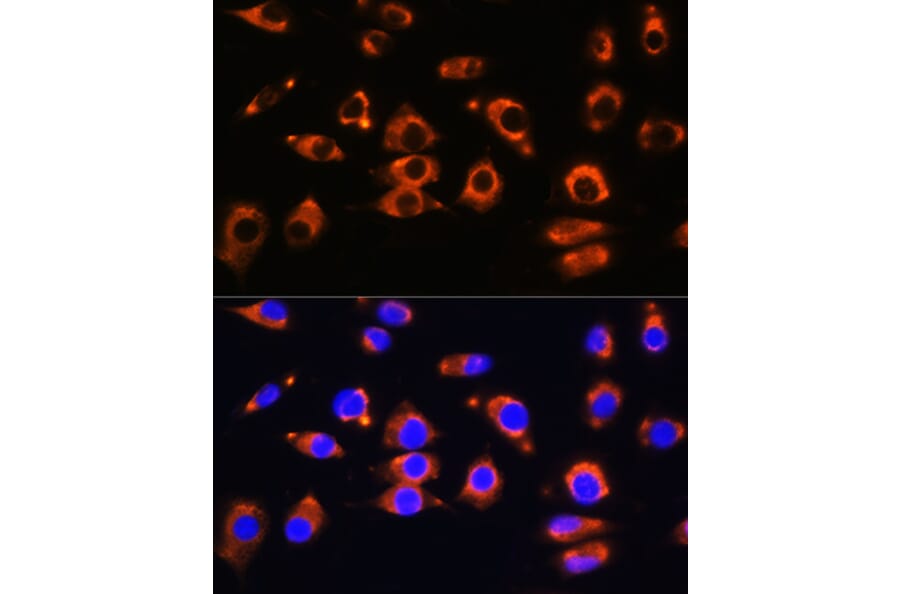 Immunofluorescence - Anti-ENPP1 Antibody (A329343) - Antibodies.com