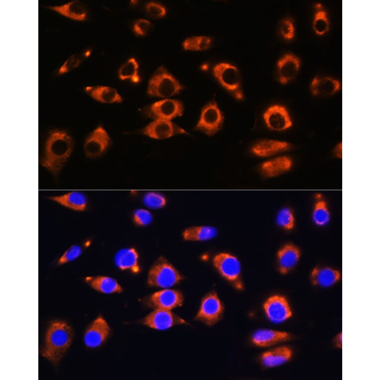 Immunofluorescence - Anti-ENPP1 Antibody (A329343) - Antibodies.com