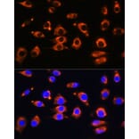 Immunofluorescence - Anti-ENPP1 Antibody (A329343) - Antibodies.com