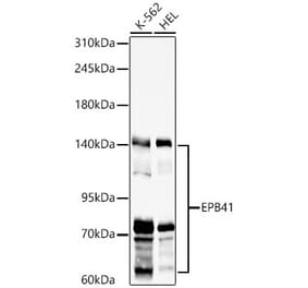 Western Blot - Anti-EPB41 Antibody (A329344) - Antibodies.com