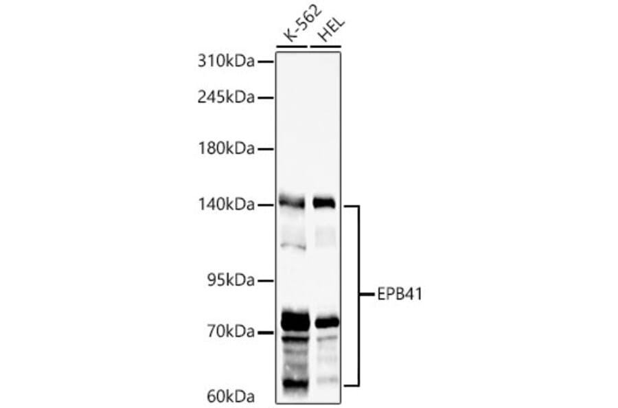 Western Blot - Anti-EPB41 Antibody (A329344) - Antibodies.com