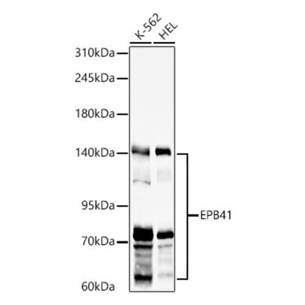 Western Blot - Anti-EPB41 Antibody (A329344) - Antibodies.com