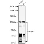 Western Blot - Anti-EPB41 Antibody (A329344) - Antibodies.com