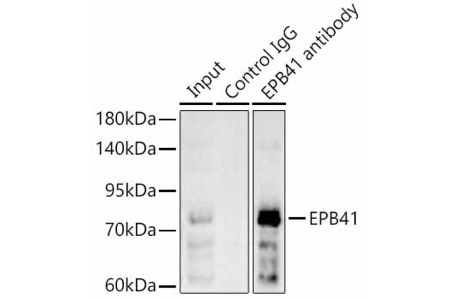 Western Blot - Anti-EPB41 Antibody (A329344) - Antibodies.com
