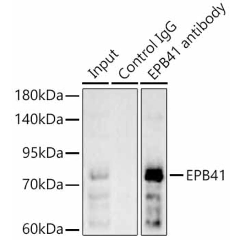 Western Blot - Anti-EPB41 Antibody (A329344) - Antibodies.com