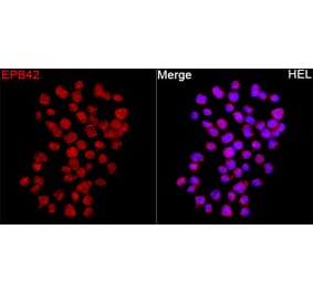 Immunofluorescence - Anti-EPB42 Antibody (A329345) - Antibodies.com