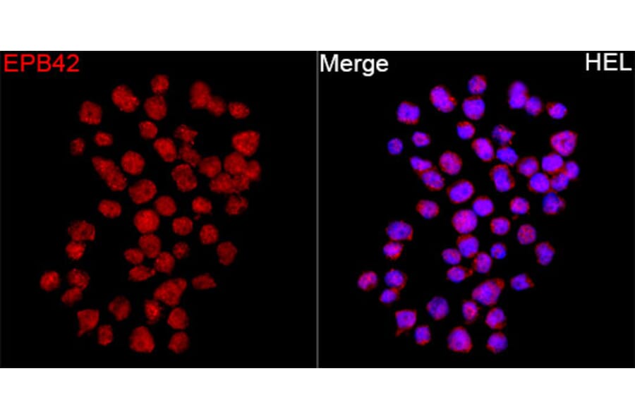 Immunofluorescence - Anti-EPB42 Antibody (A329345) - Antibodies.com