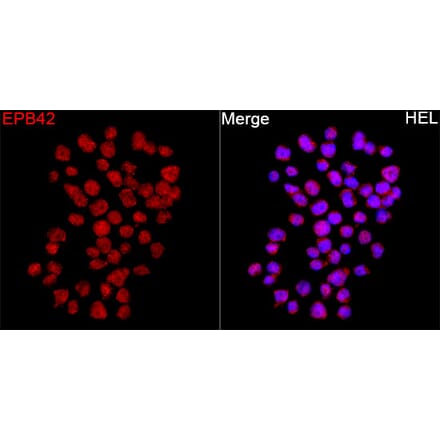Immunofluorescence - Anti-EPB42 Antibody (A329345) - Antibodies.com