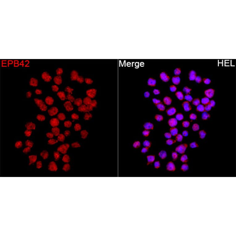 Immunofluorescence - Anti-EPB42 Antibody (A329345) - Antibodies.com