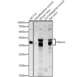 Western Blot - Anti-EpCAM Antibody (A329346) - Antibodies.com