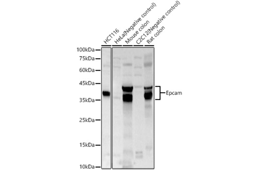 Western Blot - Anti-EpCAM Antibody (A329346) - Antibodies.com