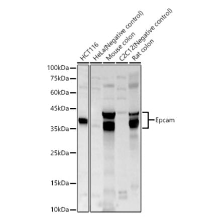 Western Blot - Anti-EpCAM Antibody (A329346) - Antibodies.com