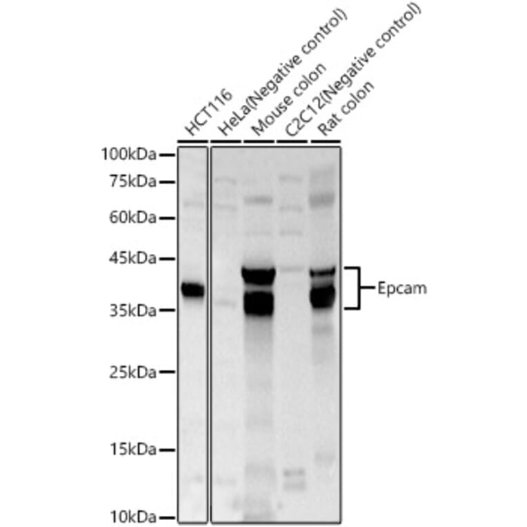 Western Blot - Anti-EpCAM Antibody (A329346) - Antibodies.com