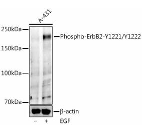 Western Blot - Anti-ErbB2 (Phospho Y1221/Y1222) Antibody (A329349) - Antibodies.com