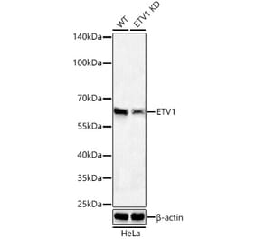 Western Blot - Anti-ETV1 Antibody [ARC60301] (A329350) - Antibodies.com