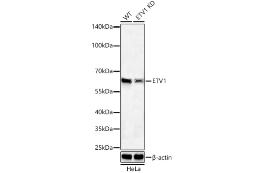Western Blot - Anti-ETV1 Antibody [ARC60301] (A329350) - Antibodies.com