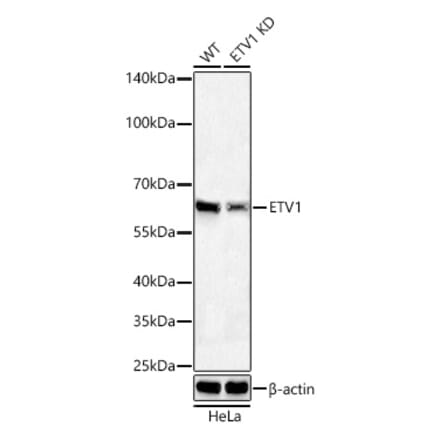 Western Blot - Anti-ETV1 Antibody [ARC60301] (A329350) - Antibodies.com