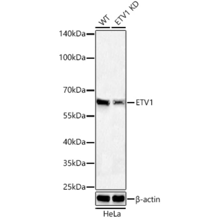 Western Blot - Anti-ETV1 Antibody [ARC60301] (A329350) - Antibodies.com