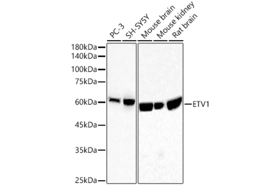 Western Blot - Anti-ETV1 Antibody [ARC60301] (A329350) - Antibodies.com