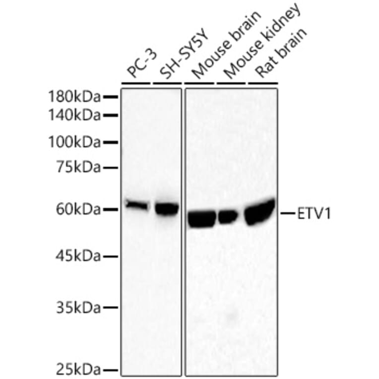 Western Blot - Anti-ETV1 Antibody [ARC60301] (A329350) - Antibodies.com