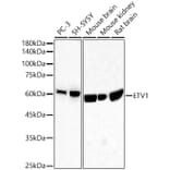 Western Blot - Anti-ETV1 Antibody [ARC60301] (A329350) - Antibodies.com