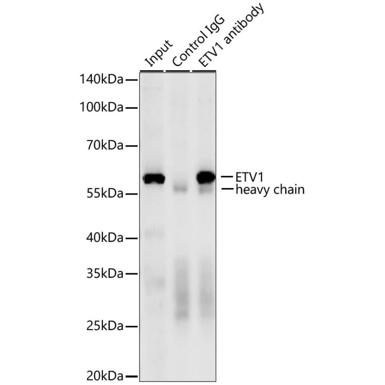 Western Blot - Anti-ETV1 Antibody [ARC60301] (A329350) - Antibodies.com