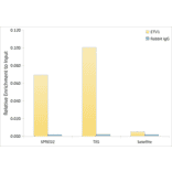 ChImmunoprecipitation - Anti-ETV1 Antibody [ARC60301] (A329350) - Antibodies.com